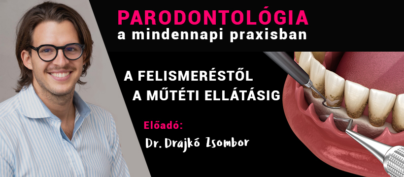 EVERYDAY PERIO – PARODONTOLÓGIA A MINDENNAPI PRAXISBAN / Dentistry Education by Dr Székely